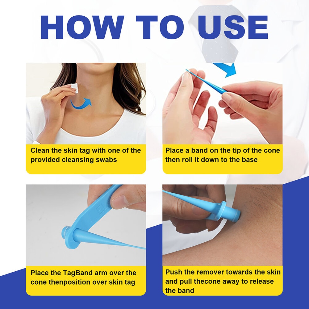 Skin Tag Removal Kit - 2-in-1 Silicone Band Ligation System for Safe Home Use